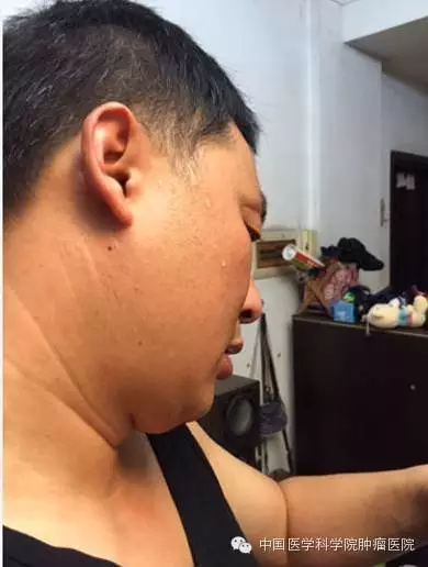 QQ图片20180326155857.png